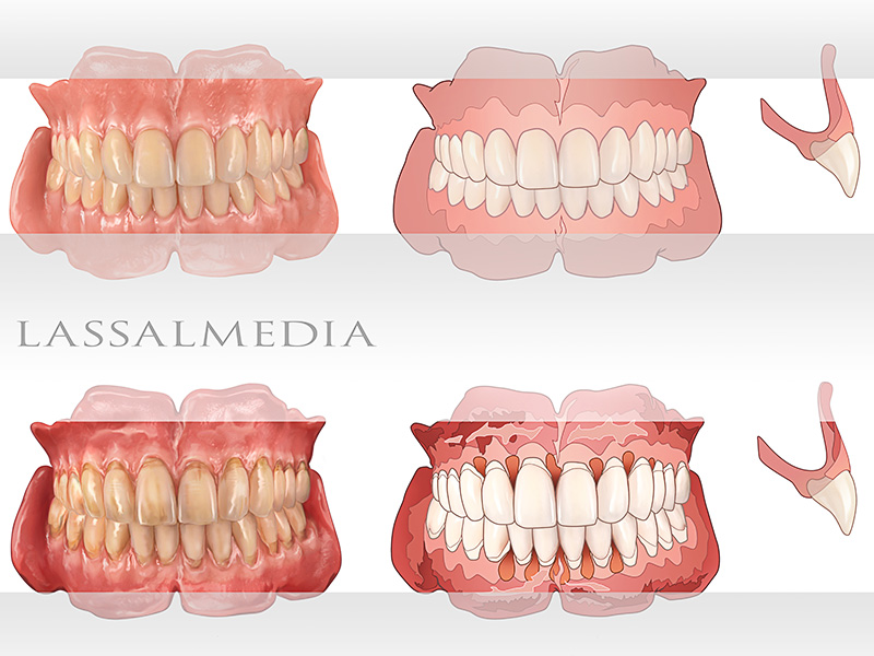 LassalMedia - False Teeth & More for Print and Web Application – Photorealistic & Vector